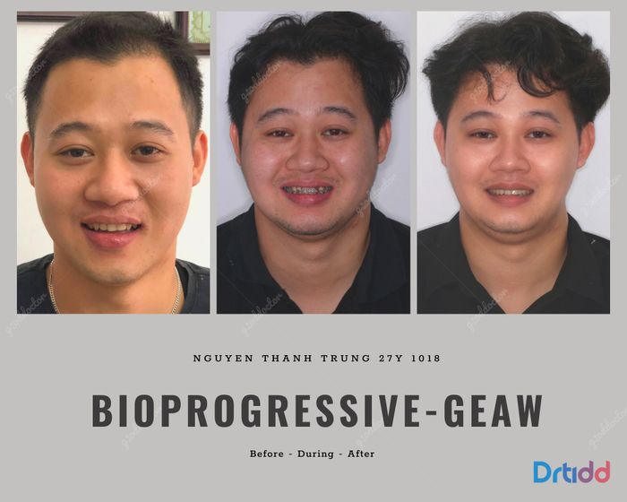 Kim Loan Dental - Hình ảnh 1: Không gian phòng khám hiện đại, nơi bắt đầu hành trình kiến tạo nụ cười hoàn hảo cho mọi khách hàng.