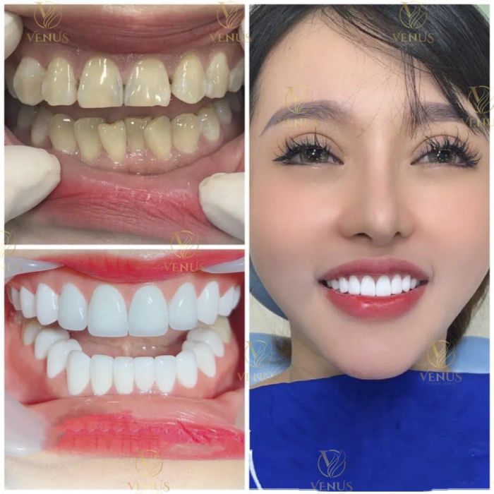 Hệ thống trang thiết bị tiên tiến tại Nha Khoa Venus