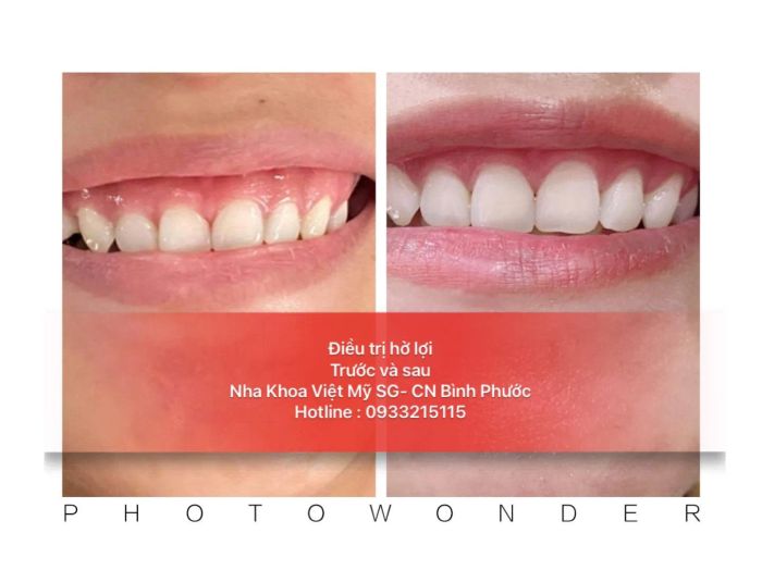 Hình ảnh thực tế tại Nha Khoa Việt Mỹ Sài Gòn - Chi nhánh Bình Phước (ảnh 2)