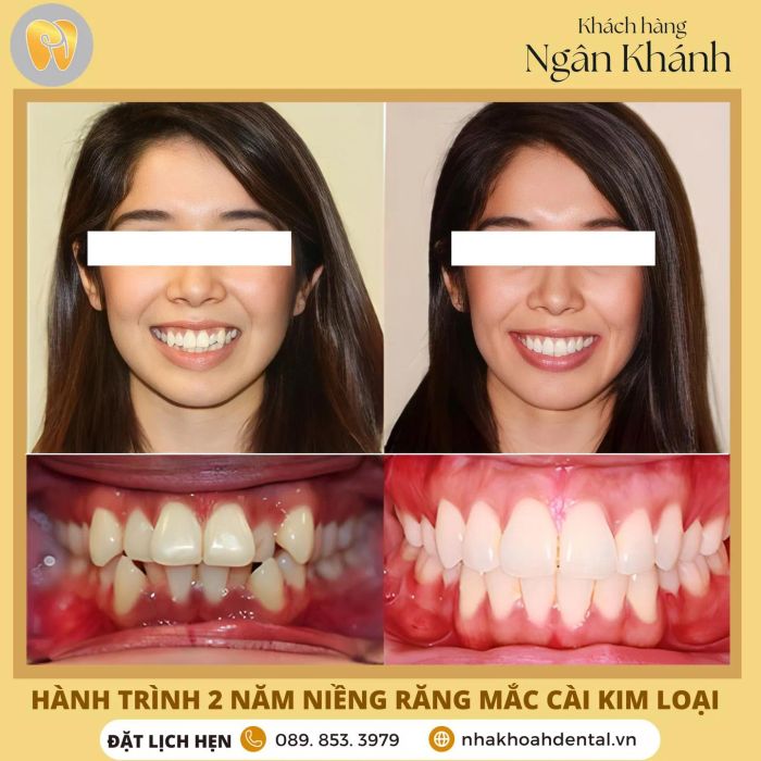 Hình ảnh Nha Khoa H Dental (ảnh 2)