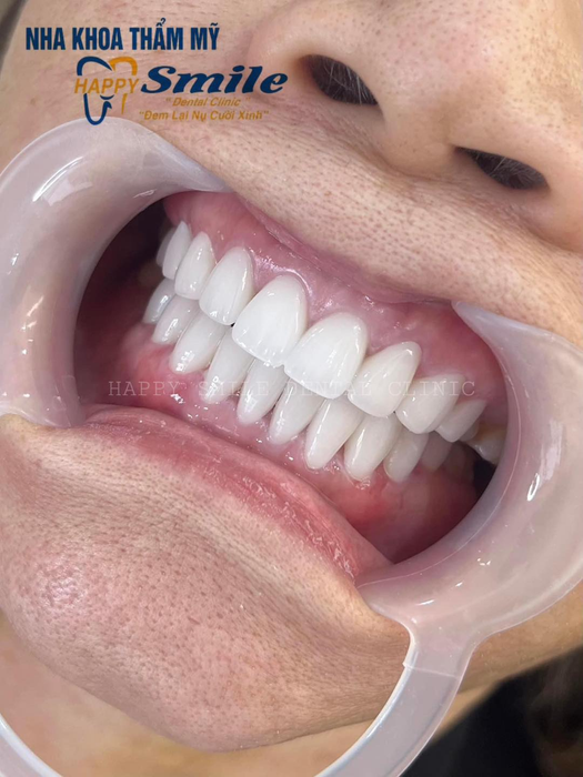 Hình ảnh đội ngũ bác sĩ chuyên nghiệp tại Nha khoa Happy Smile