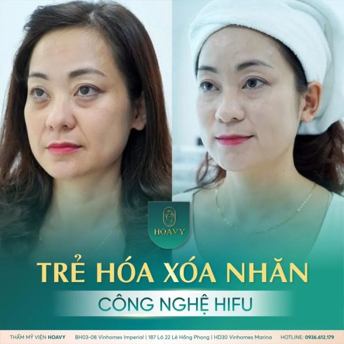 Thẩm mỹ viện HoaVy ảnh 2