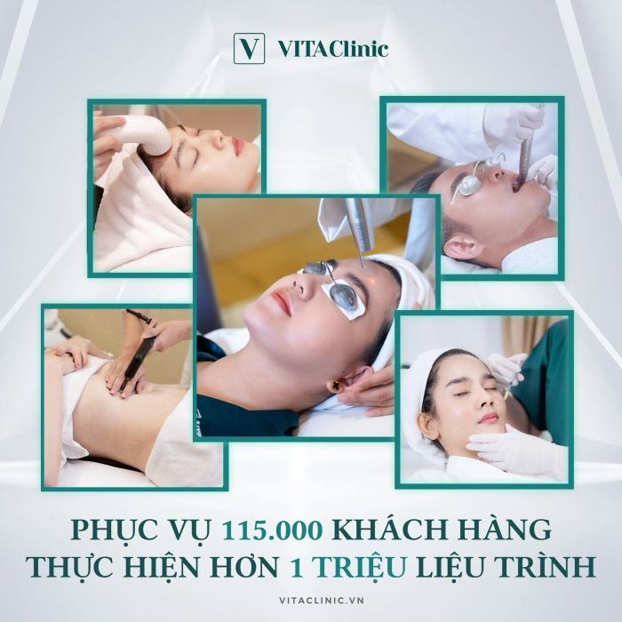 Hình ảnh quy trình nâng cơ Ultherapy chuẩn FDA tại VITA Clinic