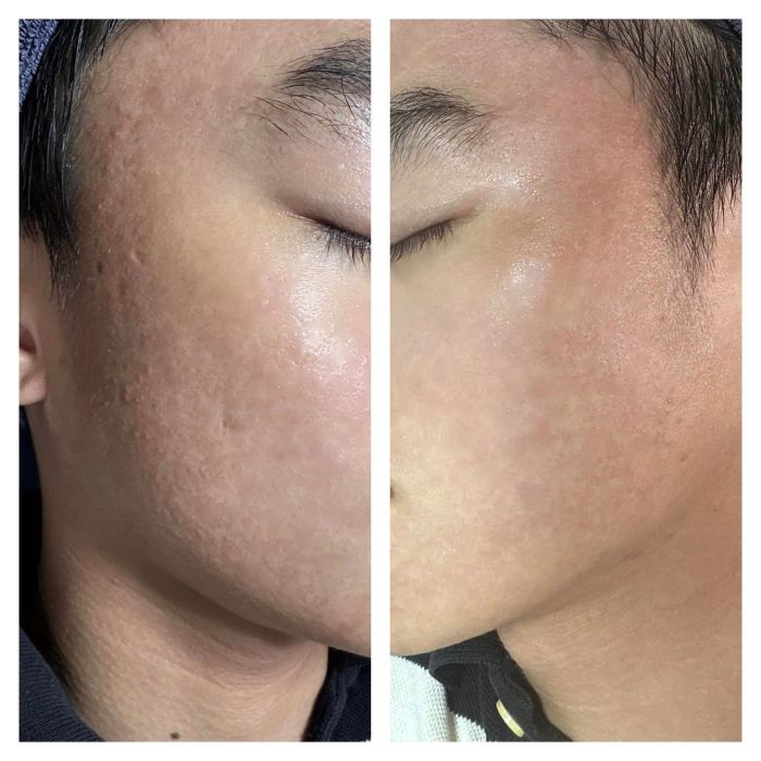 Trải nghiệm làm đẹp đẳng cấp tại Spa Trúc My