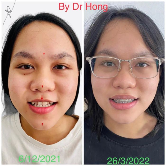 Hình ảnh Nha Khoa Kim Cương (ảnh 2)