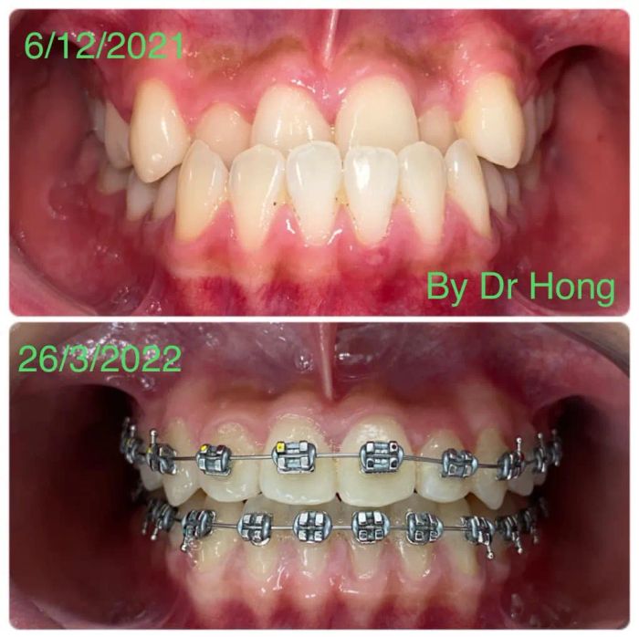 Hình ảnh Nha Khoa Kim Cương (ảnh 1)