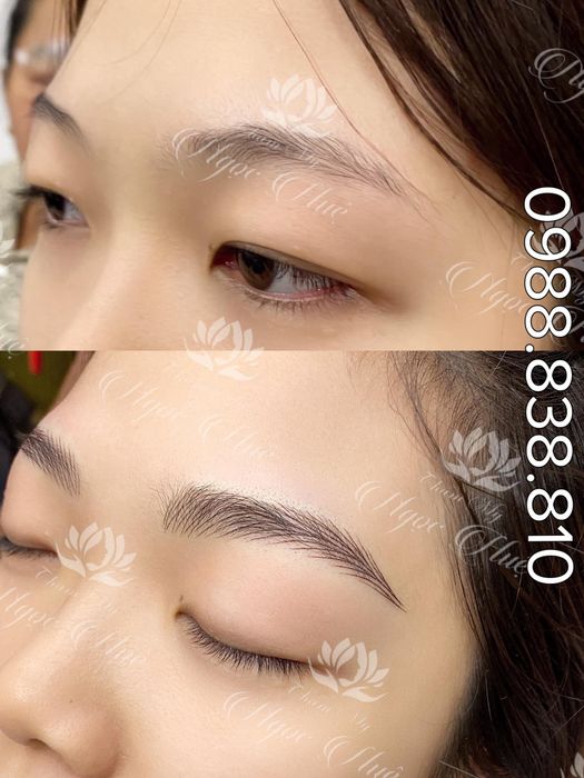 Hình ảnh thực tế dịch vụ tại Thẩm Mỹ Ngọc Huệ