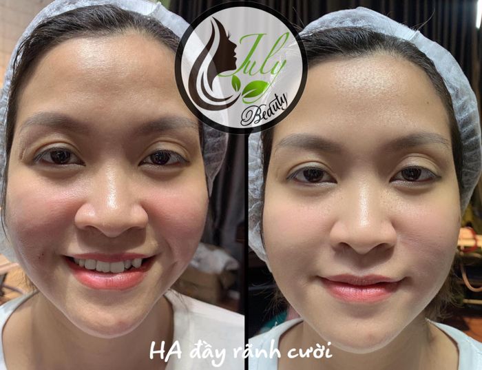 July Beauty ảnh 1