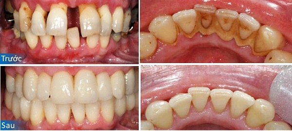 Hệ thống phòng điều trị tiêu chuẩn tại Peace Dentistry