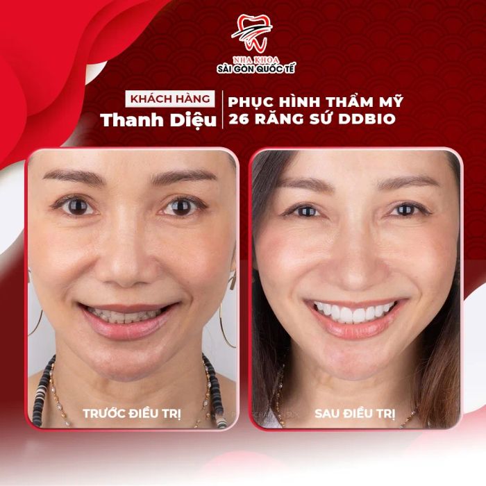 Hình ảnh Nha Khoa Sài Gòn Quốc Tế (ảnh 2)