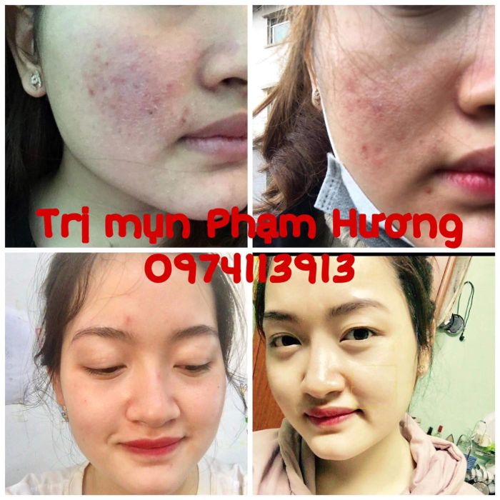 Không gian sang trọng và dịch vụ chuyên nghiệp tại Spa Phạm Hương