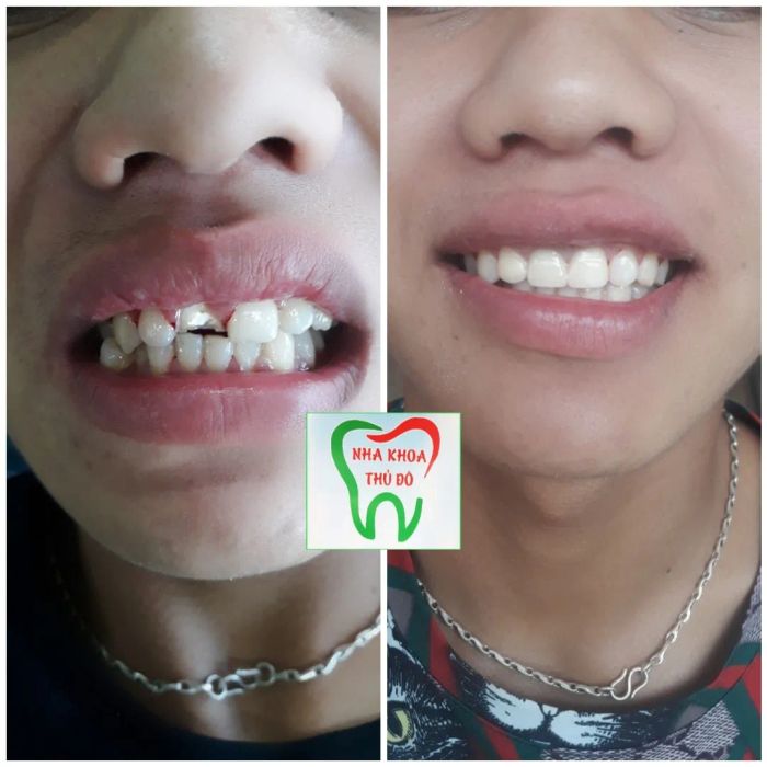 Nha Khoa Thủ Đô - Hình ảnh 2: Quy trình thăm khám chuyên nghiệp cùng đội ngũ bác sĩ giàu kinh nghiệm
