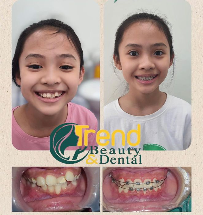 Hình ảnh Nha khoa quốc tế Trend Dental 2