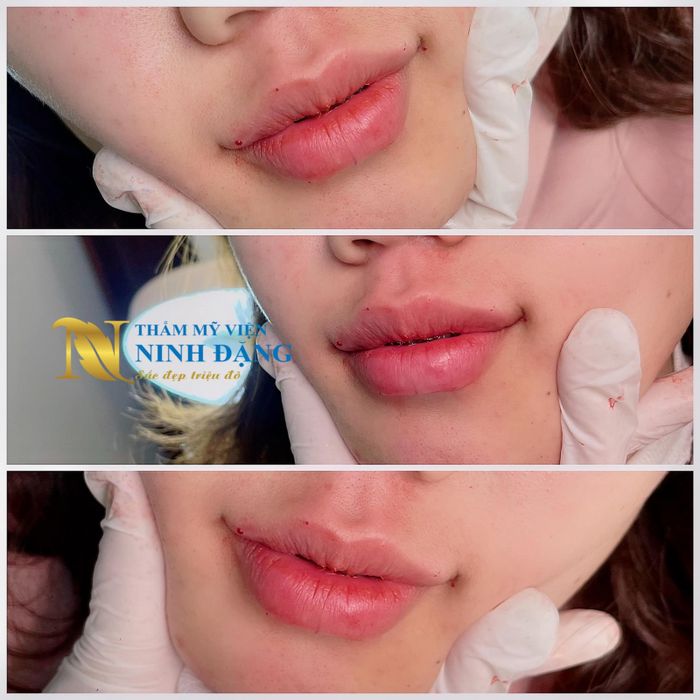 Thẩm mỹ viện Ninh Đặng hình ảnh 2