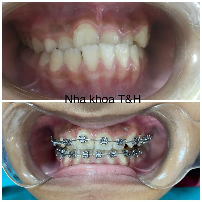 Hệ thống trang thiết bị tiên tiến tại Nha khoa - Tiêm chủng T&H