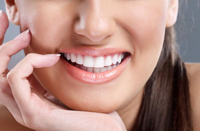 Quy trình dán sứ Veneer chuyên nghiệp tại Smile Cần Thơ