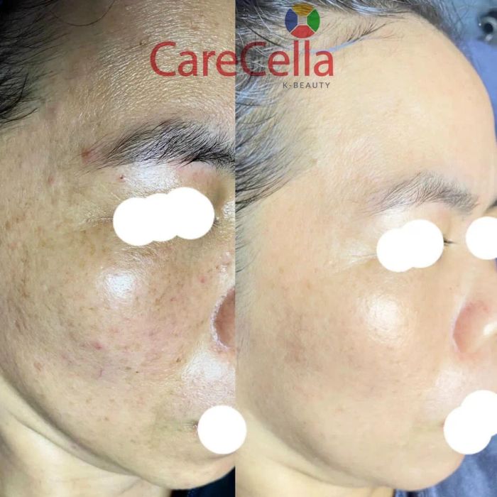 Trải nghiệm thư giãn tuyệt vời tại Mộc Lam CareCella Spa