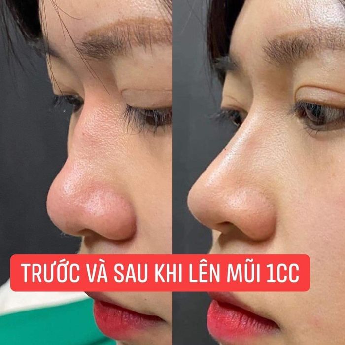 Tố Diễm Beauty ảnh 2