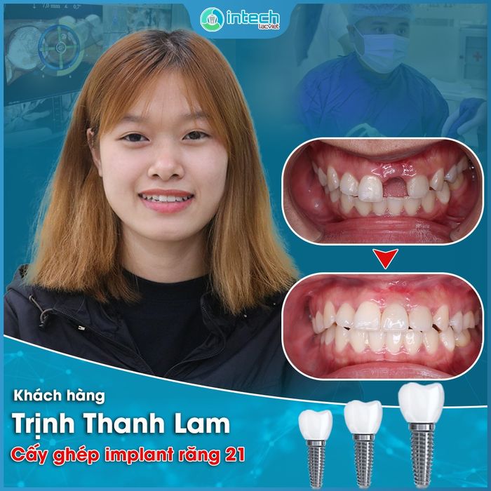 Hình ảnh phòng khám đạt chuẩn quốc tế tại Nha khoa Lạc Việt Intech