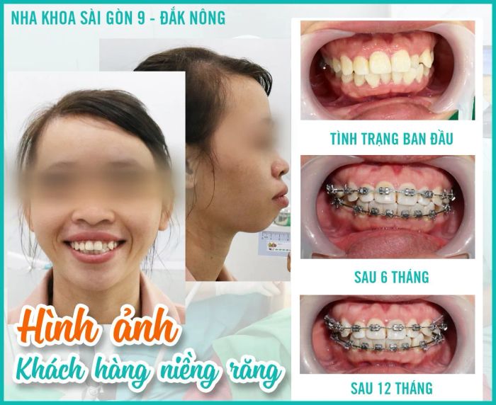 Hình ảnh Nha Khoa Daknong - Nha Khoa Sài Gòn 9 (ảnh 2)