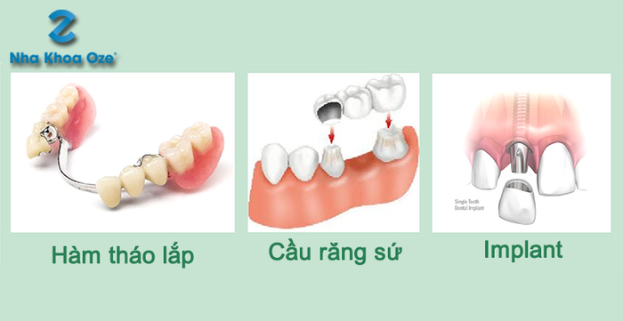 Hình ảnh cơ sở vật chất hiện đại tại Nha khoa OZE