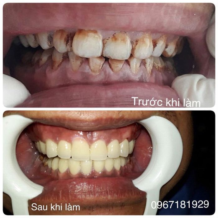 Hệ thống trang thiết bị tiên tiến đạt chuẩn quốc tế tại Nha Khoa Sài Gòn