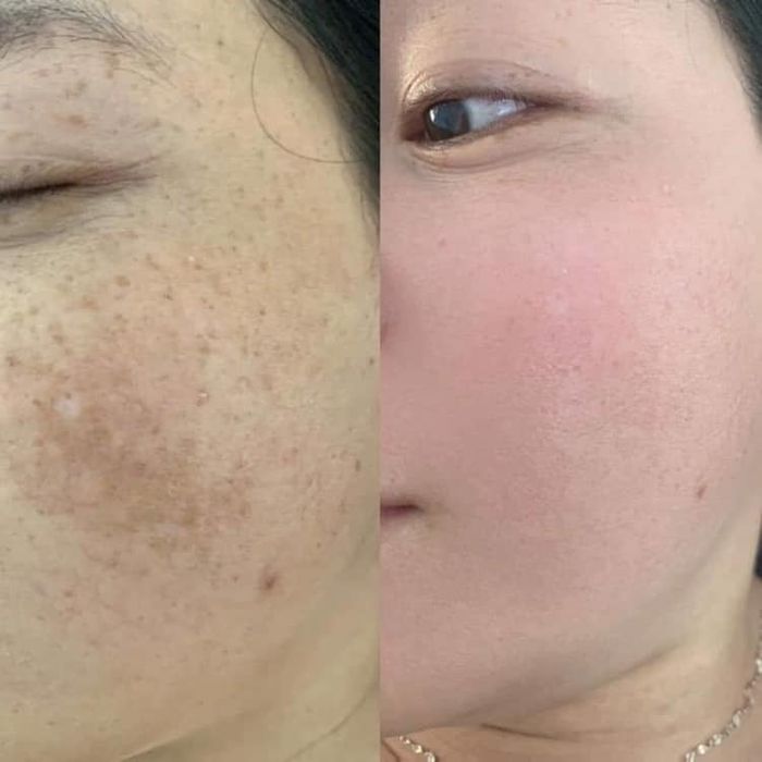 HP Beauty Spa - Ảnh 2