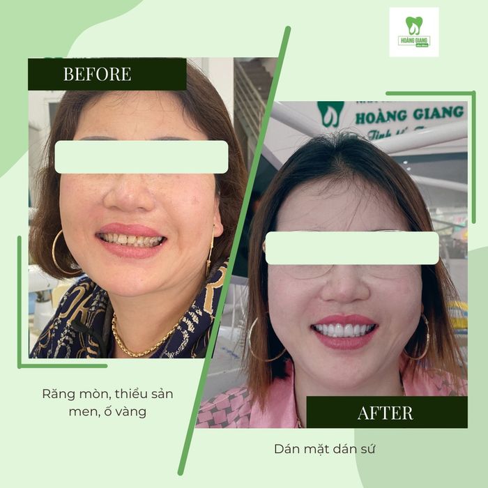 Hình ảnh Nha khoa HOÀNG GIANG 2