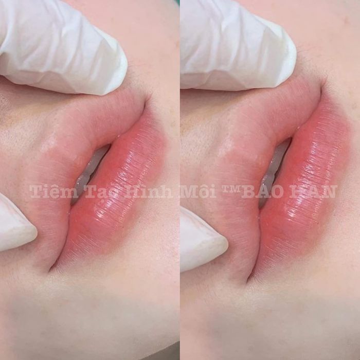Bảo Hân Beauty Center ảnh 2