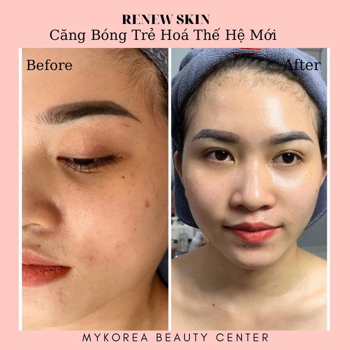 My Korea Beauty Center - Ảnh 2