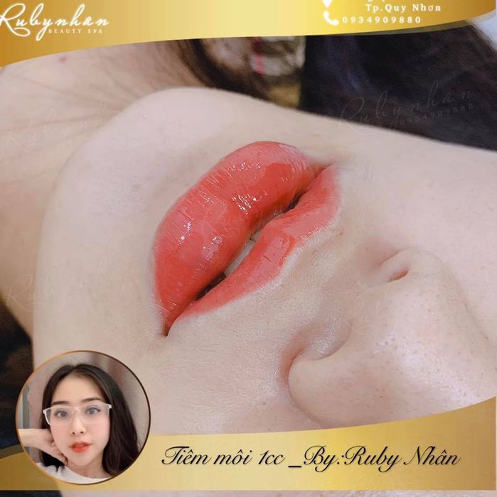 Viện Thẩm Mỹ Quốc Tế RuBy ảnh 1