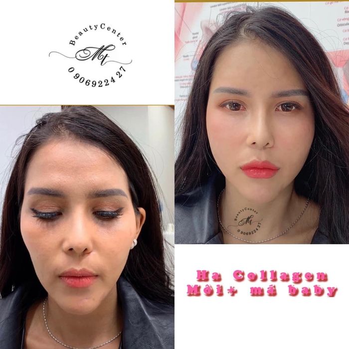Viện Thẩm Mỹ My Trang ảnh 1