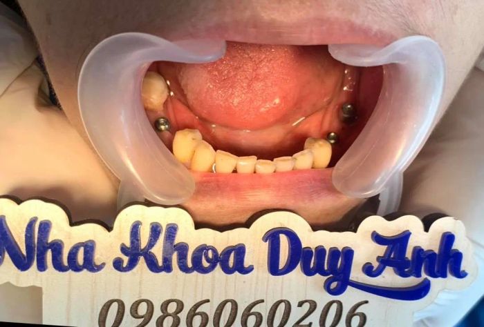 Không gian hiện đại tại Nha Khoa Duy Anh