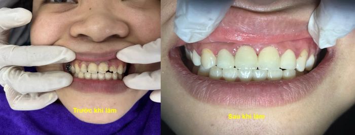 Hình ảnh Nha Khoa Bảo Anh (ảnh 2)