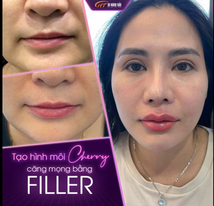 Thẩm mỹ Hoàng Tuấn hình ảnh 1