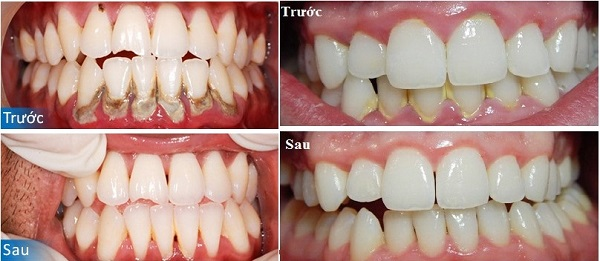 Không gian hiện đại tại Nha khoa Peace Dentistry