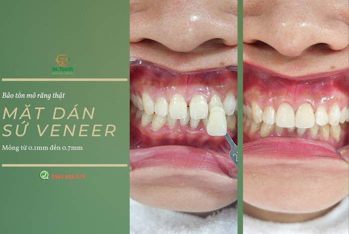 Hình ảnh không gian hiện đại tại Nha khoa Dr.Tooth