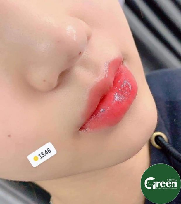 Bệnh viện Quốc tế Green hình ảnh 1