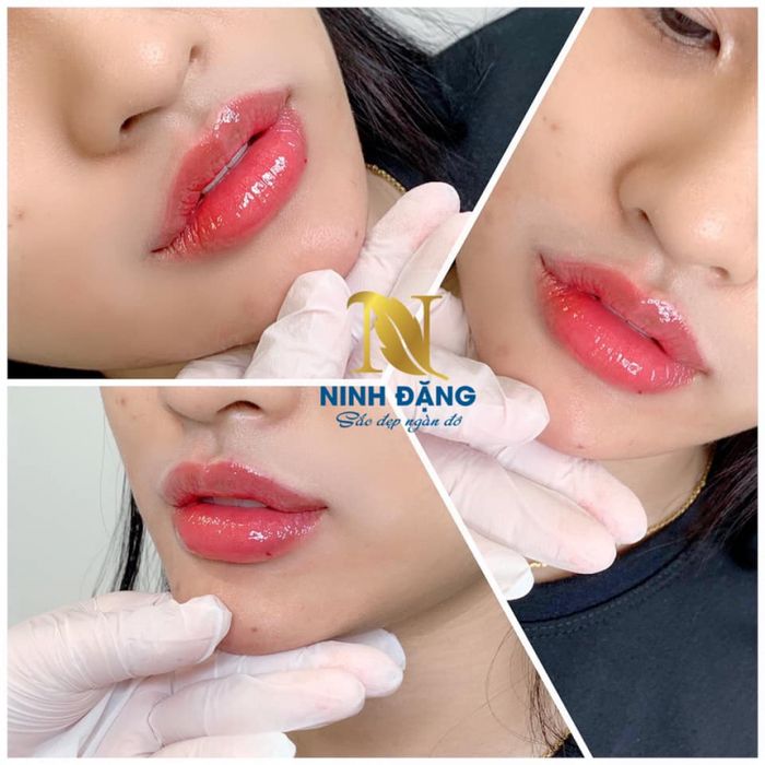 Thẩm mỹ viện Ninh Đặng hình ảnh 3