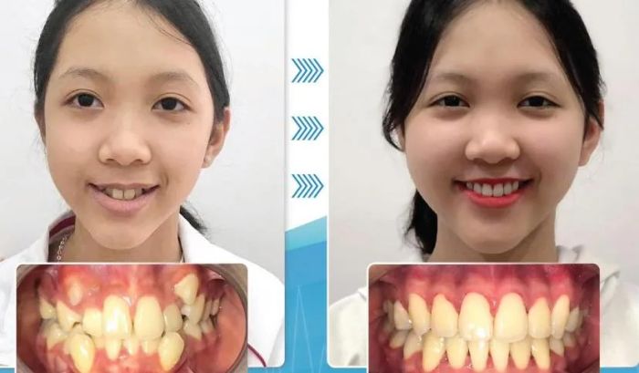 Hình ảnh Nha Khoa Á Châu (ảnh 1)