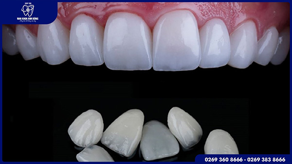 Hình ảnh cơ sở vật chất hiện đại tại Nha khoa Anh Dũng