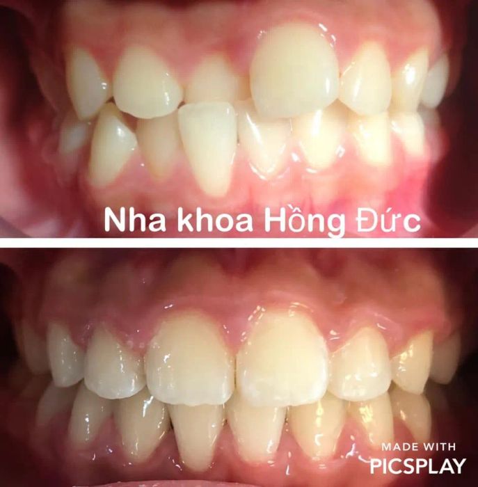 Nha Khoa Hồng Đức - Hình ảnh 2: Đội ngũ bác sĩ tận tâm cùng quy trình chuẩn quốc tế