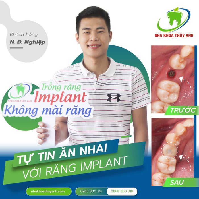 Hình ảnh phòng khám hiện đại tại Nha khoa Thùy Anh