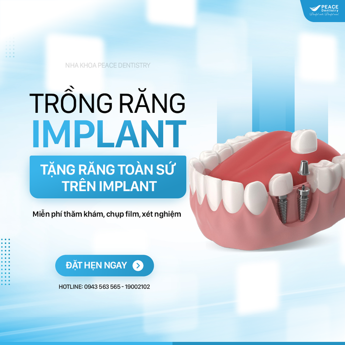 Hình ảnh Nha khoa Peace Dentistry - Không gian sang trọng với hệ thống phòng khám hiện đại