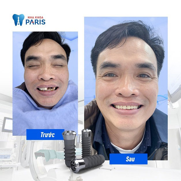 Hình ảnh Nha khoa Paris - Không gian sang trọng đạt chuẩn phòng khám quốc tế