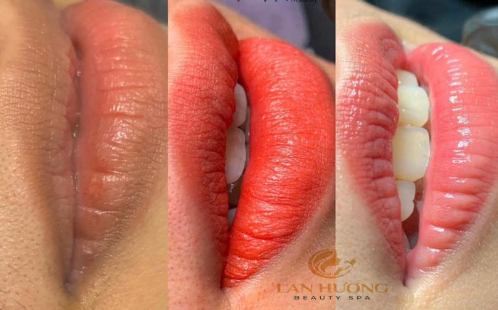Thẩm mỹ viện Lan Hương – Khoảnh khắc vẻ đẹp được tỏa sáng rạng rỡ.