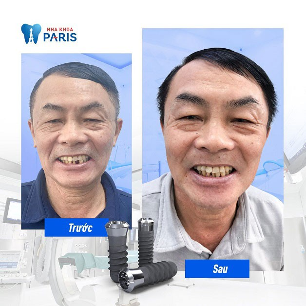 Hình ảnh đội ngũ bác sĩ Nha khoa Paris - Chuyên gia Implant đẳng cấp quốc tế