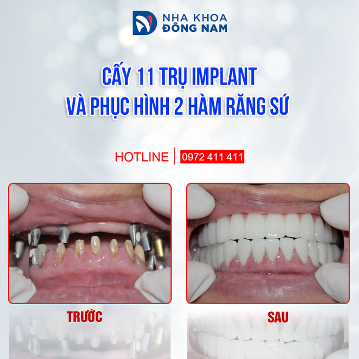 Hình ảnh thực tế Nha khoa Đông Nam - Phòng khám đạt chuẩn quốc tế với hệ thống máy móc hiện đại