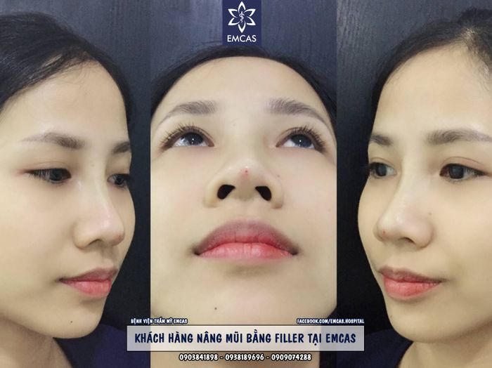 Bệnh viện Thẩm mỹ EMCAS – Hình ảnh 2