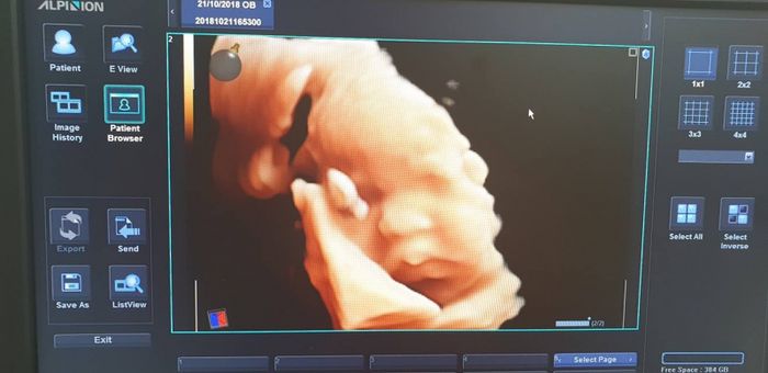 Khám phá không gian hiện đại và dịch vụ chuyên nghiệp tại Phòng Khám Phụ Sản Thái Hà qua hình ảnh thực tế